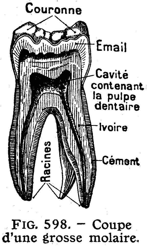 dents-2
