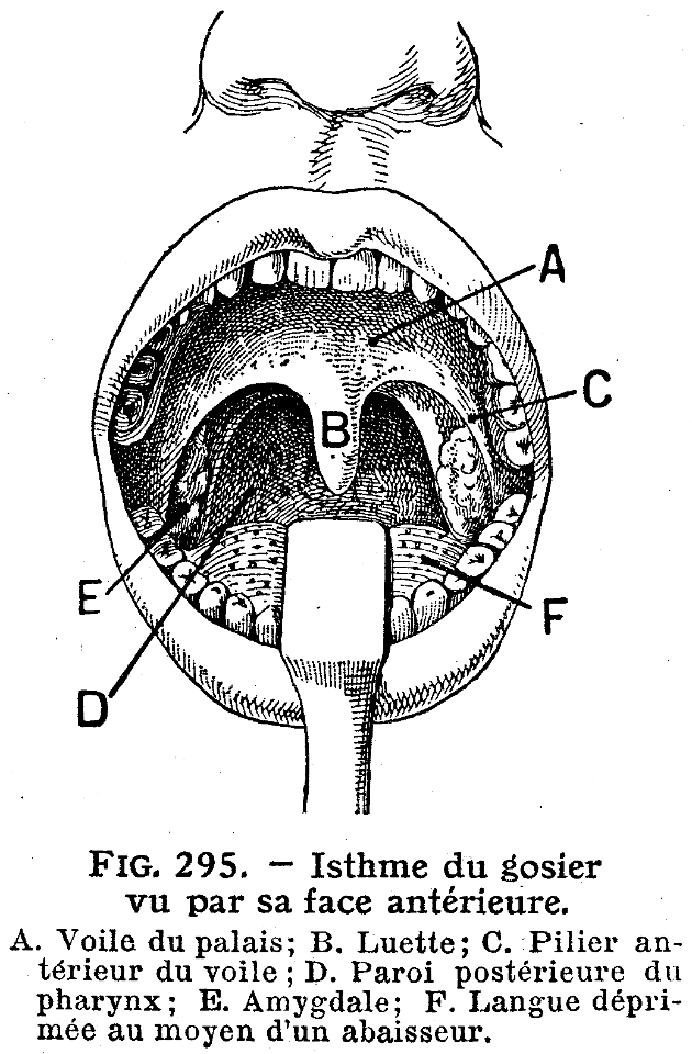 isthme du gosier