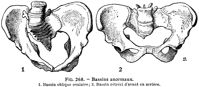 bassins anormaux