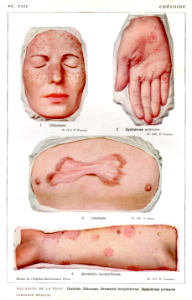 maladies de la peau
