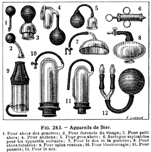 appareils de Bier