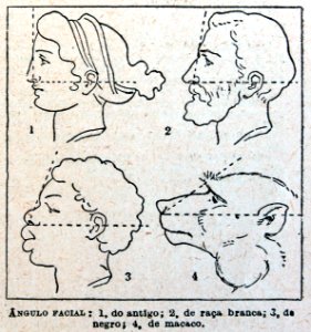 "Ángulo facial".