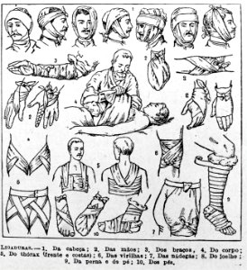 "Ligaduras".