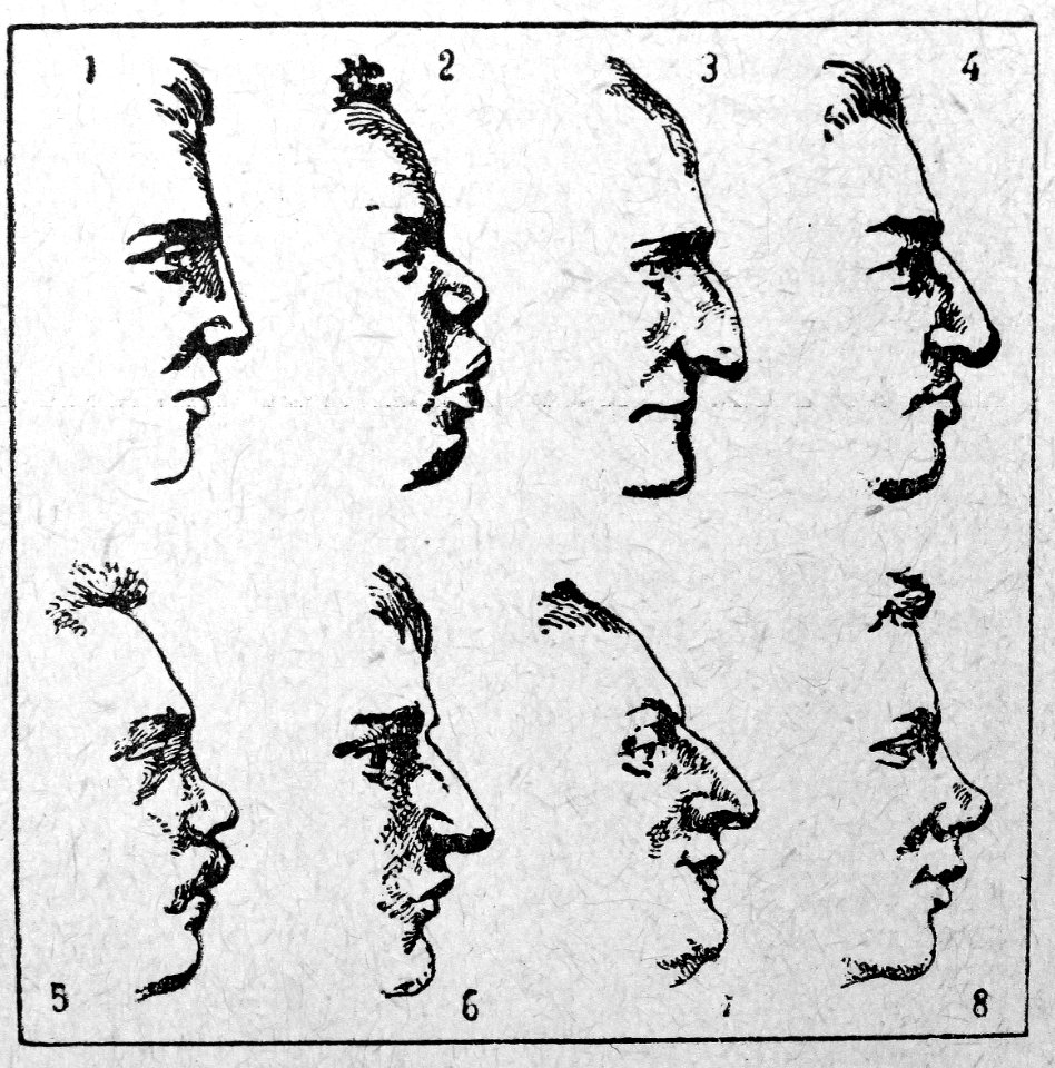 Nariz. 1. Recto. 2. Achatado 3. De cavallete 4. Cahido 5. …