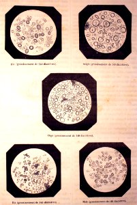"Granules microscopiques de l'amidon du blé, du seigle, de…. Free illustration for personal and commercial use.