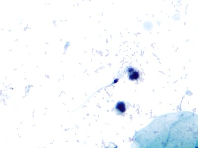 Espermatozoides (9399641653)