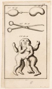 Afbeelding, fol. 178, schapenblaas, schaar en Siamese tweeling, objectnr A 19450