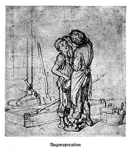 Aus Hendschel’s Skizzenbuch Augenoperation dgE