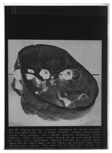 Avgjutning av KXIIs skalle m rekonstruktion av skottet - Livrustkammaren - 27057-negative