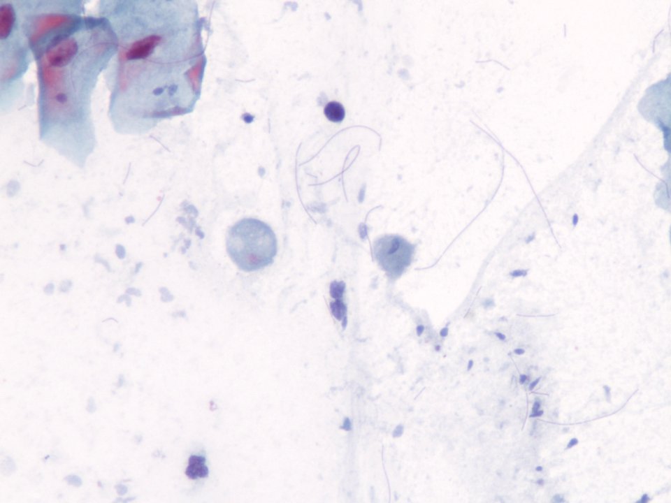 Trichomonas vaginalis (03)