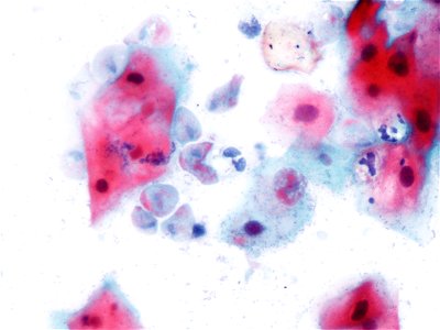 Trichomonas (9392520154)