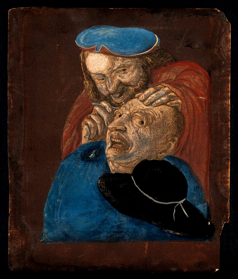 A malicious itinerant surgeon extracting stones from a grima Wellcome V0016247EL
