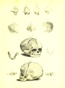 Barclay Mitchell Skeletons 0133 Plate 31