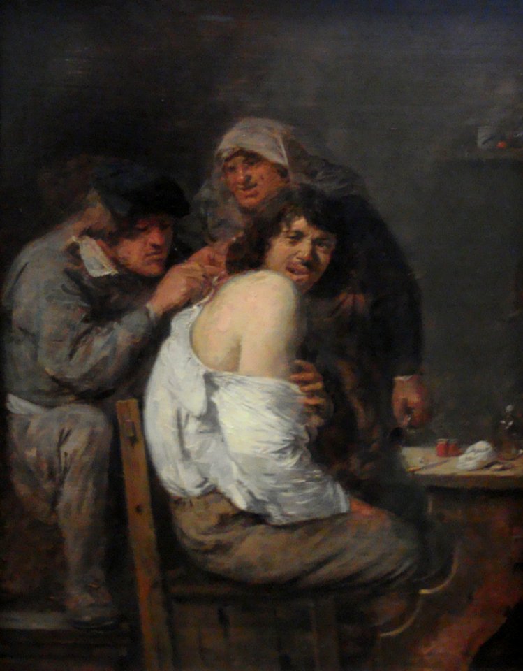 1636 Brouwer Die Operation am Ruecken anagoria