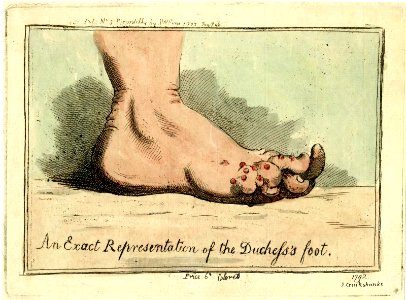 An exact representation of the Duchess's foot. (BM 1868,0808.6152)