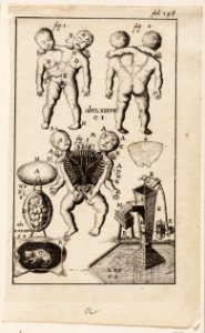 Anatomische afbeelding, fol. 158, 3 Siamese tweelingen, een kat in een ei en een pomp, objectnr A 19439