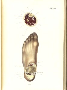 Braune Topiographisch-anatomischer Atlas 27
