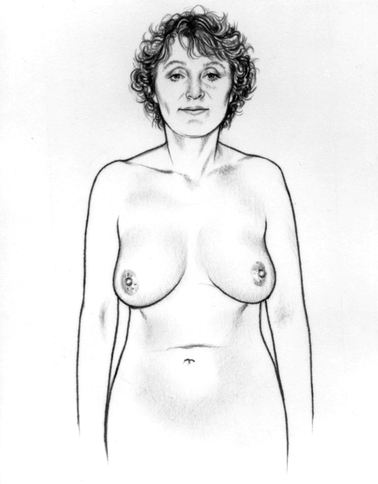 Breast self-exam illustration (series of 6)