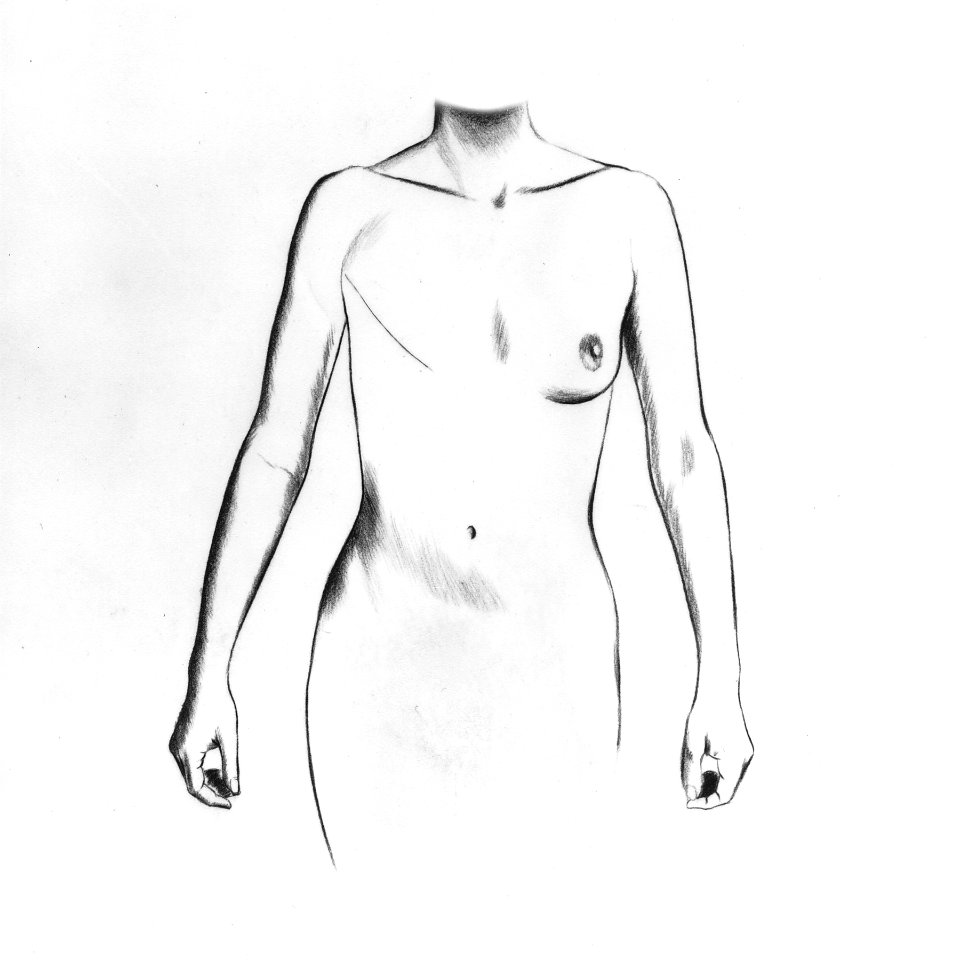 Breast reconstruction implant illustration (1)