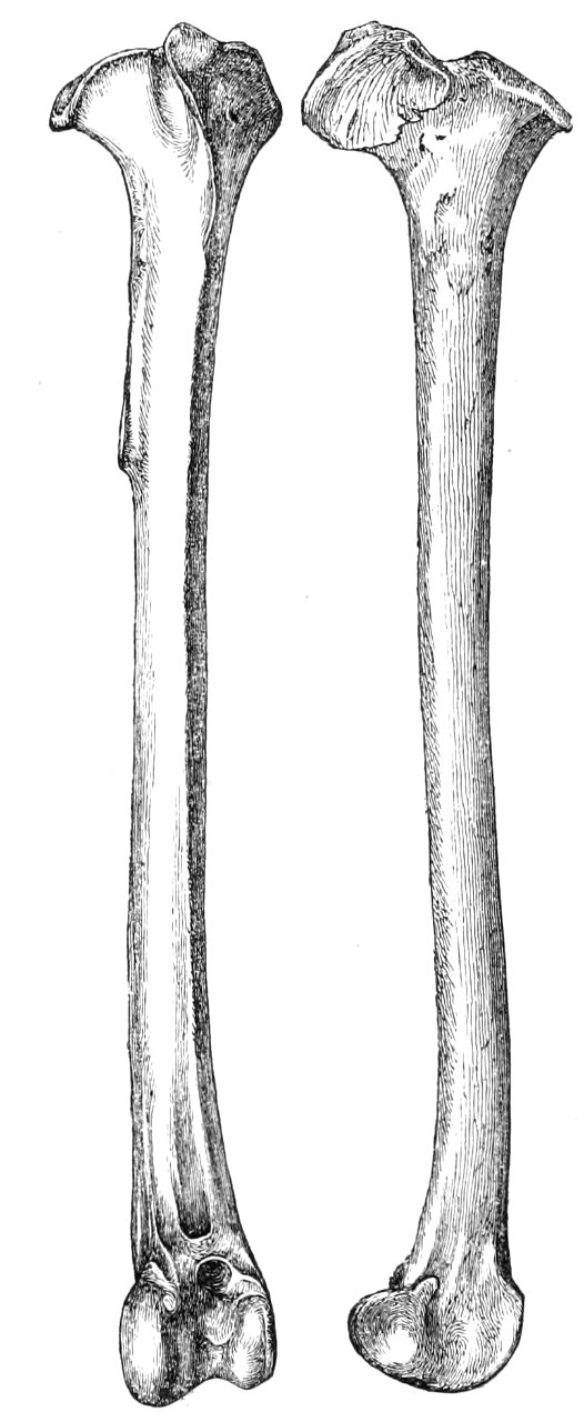 Aphanapteryx bonasia tibia 1869