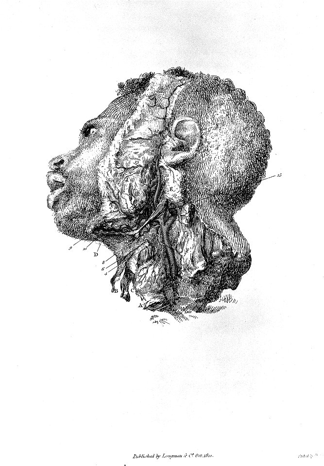 Arteries of the head, 1811 Wellcome L0023256