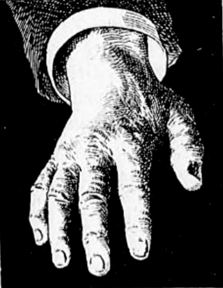 Bérillon - La psychologie de la race allemande, 1917 (page 23 crop)-1
