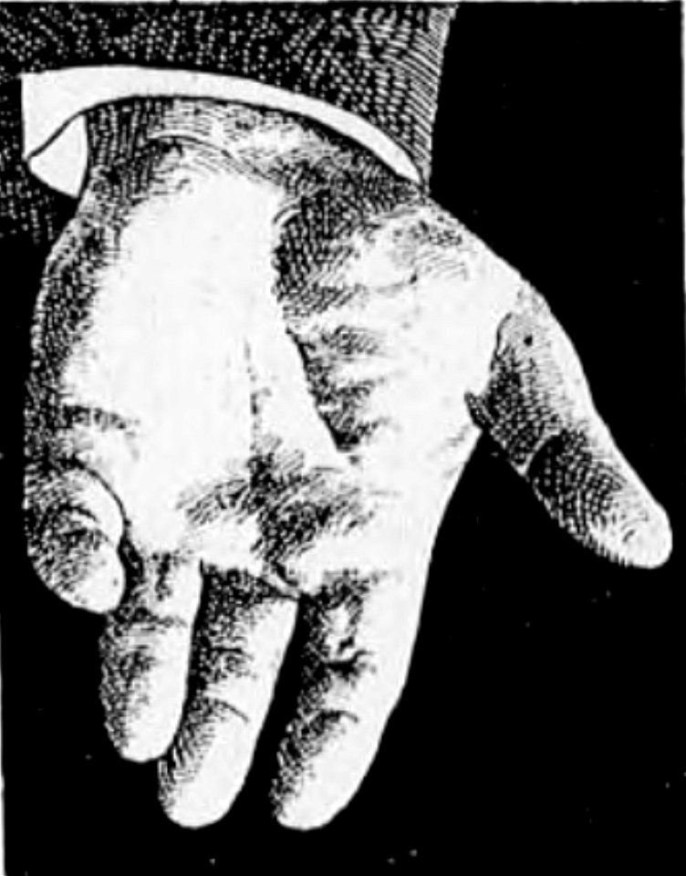 Bérillon - La psychologie de la race allemande, 1917 (page 23 crop)-3