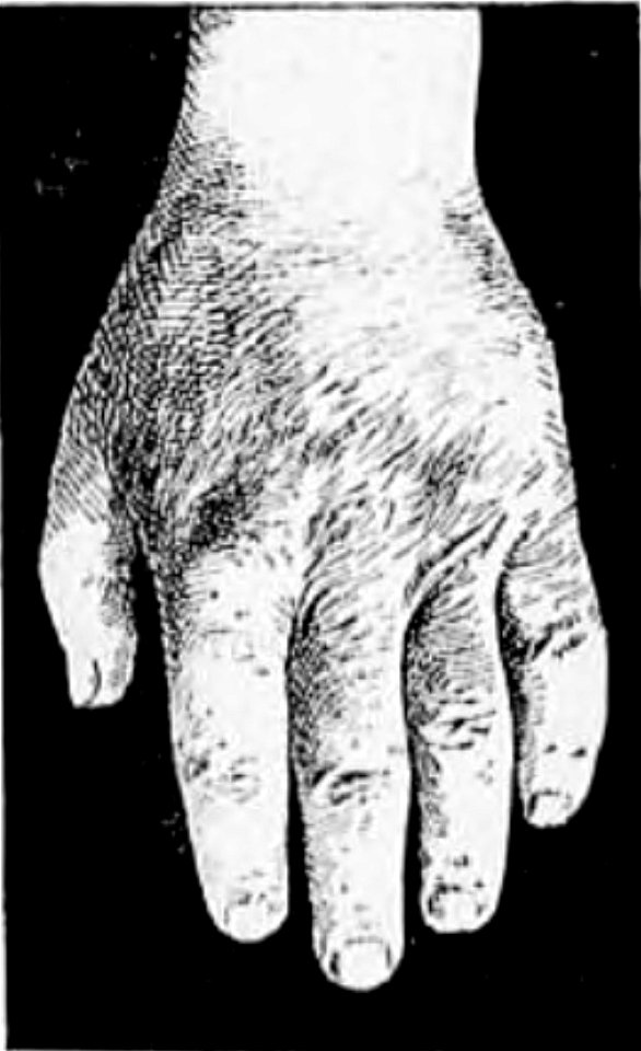 Bérillon - La psychologie de la race allemande, 1917 (page 23 crop)-2