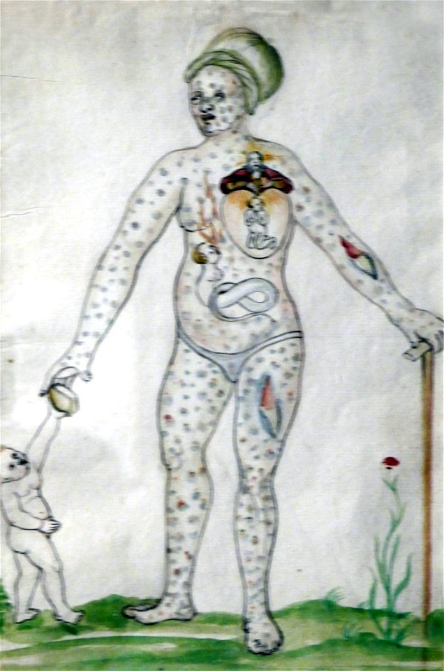 Clemens Ziegler-Le combat de l'âme dans le corps d'une femme (1532)