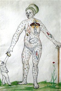 Clemens Ziegler-Le combat de l'âme dans le corps d'une femme (1532)(2)