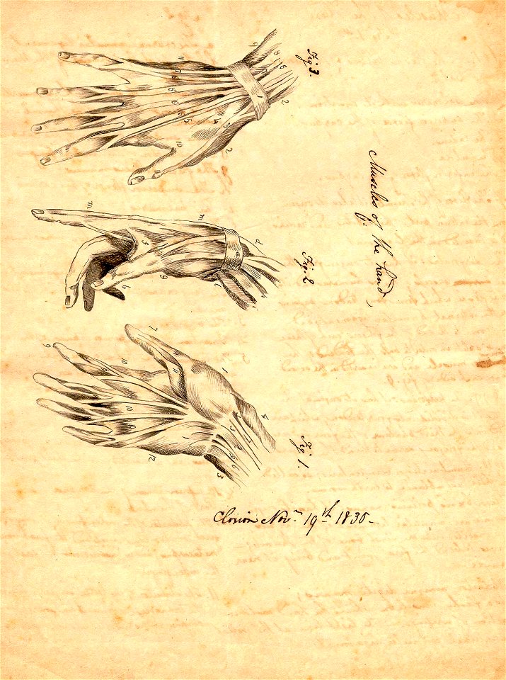 Clorion 10