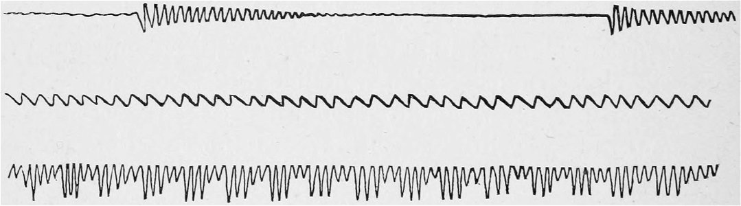 Descriptive Zoopraxography 042