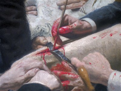 Detail 2 the gross clinic thomas eakins