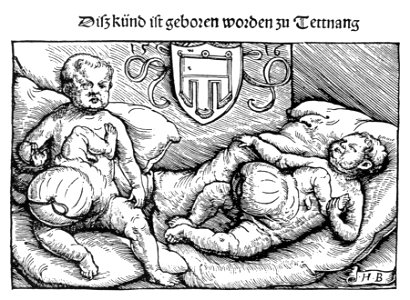 Geburtsfehler Tettnang 1516