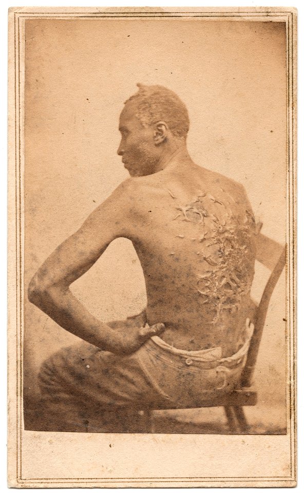 Gordon, scourged back, NY Met, 1863