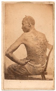 Gordon, scourged back, NY Met, 1863