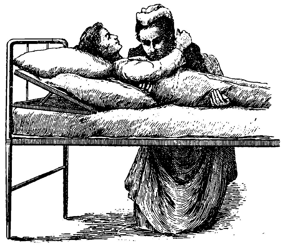 Grierson 111a Mujer levantando enfermo de la cama