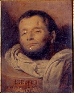 François-Gabriel-Guillaume Lépaulle - Tête de Giuseppe Fieschi (1790-1836), après son exécution - P2548 - Musée Carnavalet