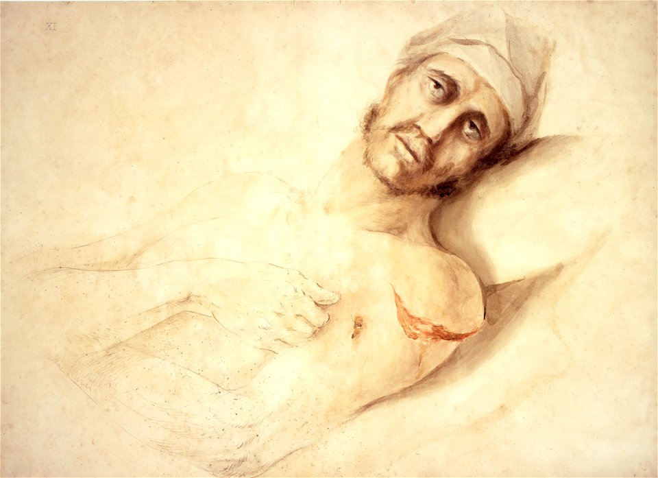 Gunshot wound to arm, by Charles Bell Wellcome L0028899