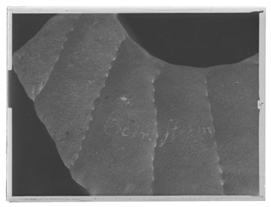 Halsputa - Livrustkammaren - 36910-negative