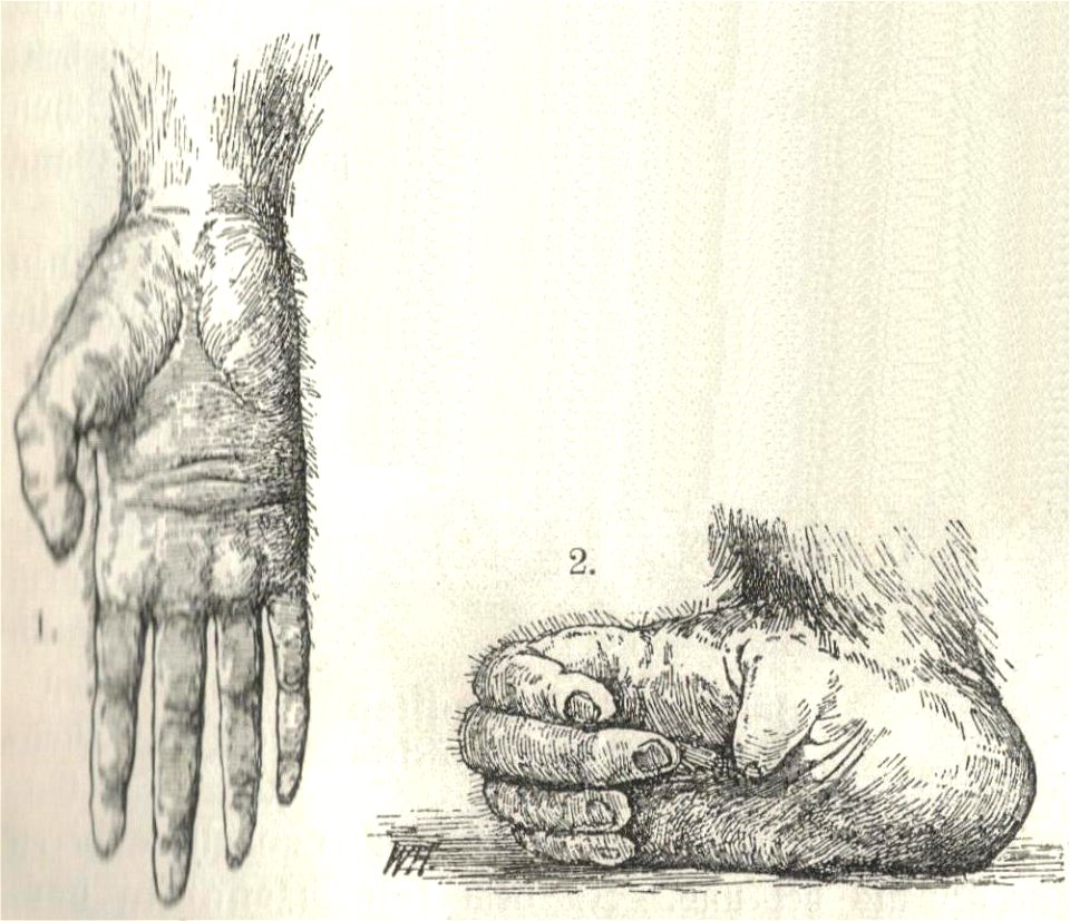 Heubach orangutan hand and foot