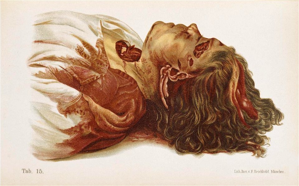 Hofmann Lehrbuch killed woman