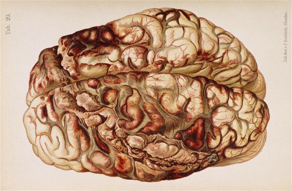 Hofmann Lehrbuch brain gunshot