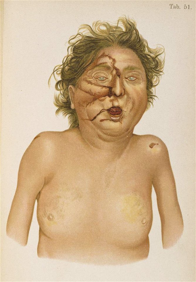 Hofmann Lehrbuch carbonmonoxide