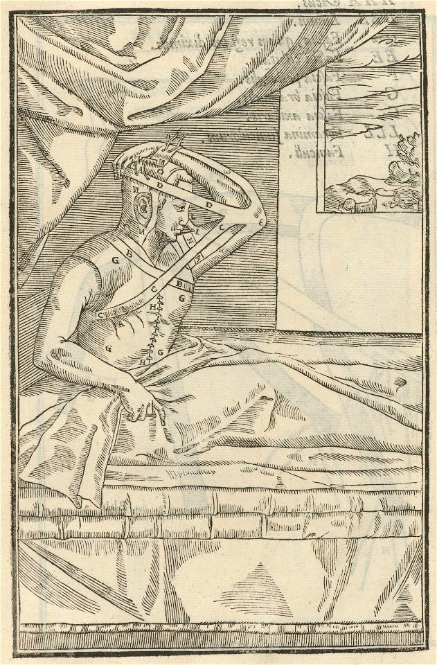 Houghton Typ 525.97.820 - De curtorum chirurgia per insitionem, icon octua - cropped
