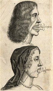 Houghton EC65.P93165.665v - The Vocal Organ, illustration