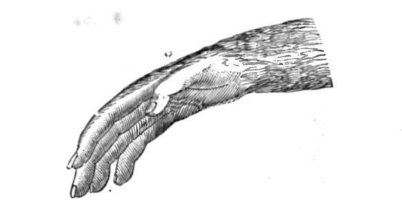 Huxley - De la place de l'homme dans la nature (page 247 crop)