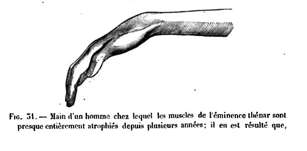 Huxley - De la place de l'homme dans la nature (page 246 crop)-1