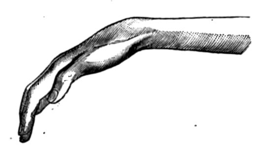Huxley - De la place de l'homme dans la nature (page 246 crop)-3