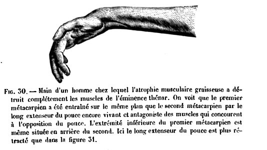 Huxley - De la place de l'homme dans la nature (page 246 crop)